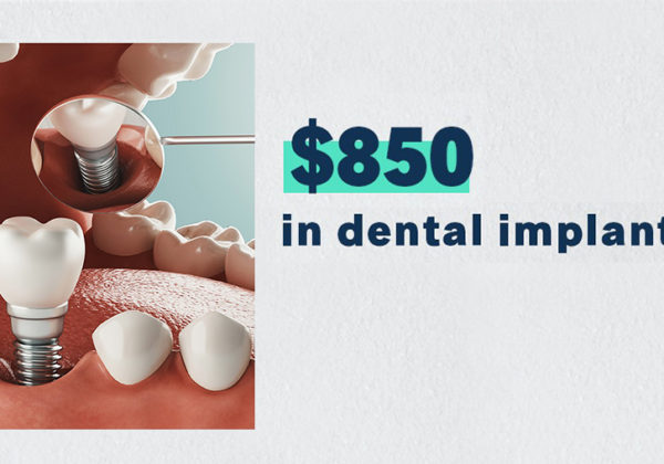 DENTAL IMPLANTS