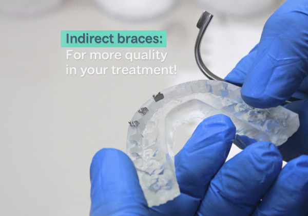 INDIRECT BRACES